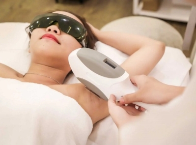 Triệt Lông Công Nghệ Cao – Giải Pháp Cho Làn Da Dưới Cánh Tay Trắng Mịn